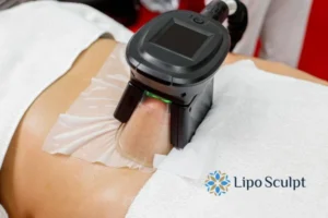 Does Fat Freezing At Home Work? 3 Fat freezing at home from Lipo Sculpt Swansea